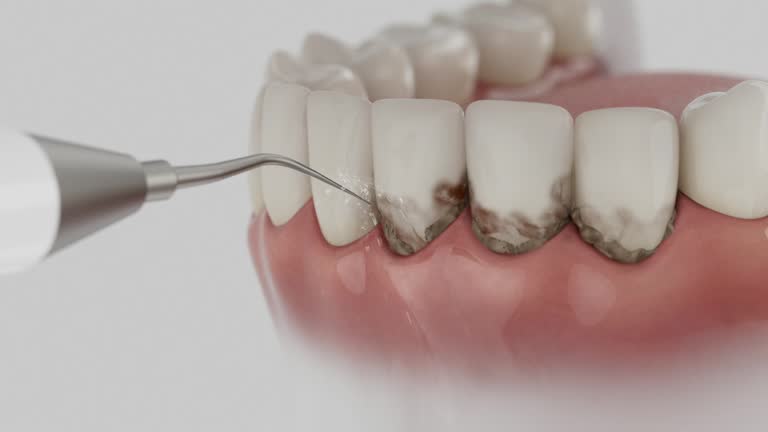 Trusted Dental Implants service in West Jefferson, OH - Dentist Open Now